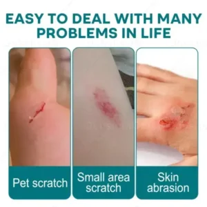 Croaie® SKINSHIELD QUICKDRYING LIQUID BANDAGE