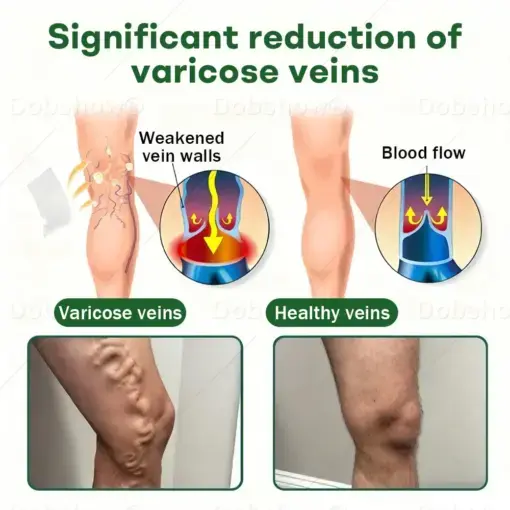 Croaie® VeinLock Microneedle Patch