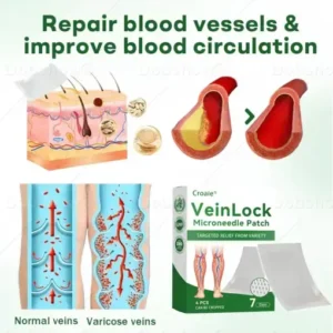 Croaie® VeinLock Microneedle Patch