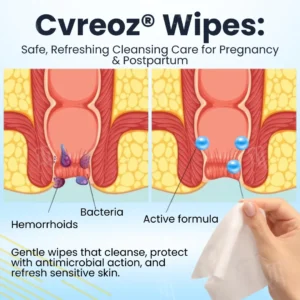 Cvreoz® Herbal Hemorrhoid Treatment Anal Spray + Wipes