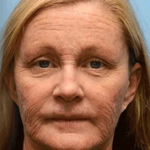 ⏰ Last Day! 70% OFF 💫 Rolimey® Botox & Vita-A Retinol Wrinkle-Lift Cream – Made & Shipped from CA 🔥