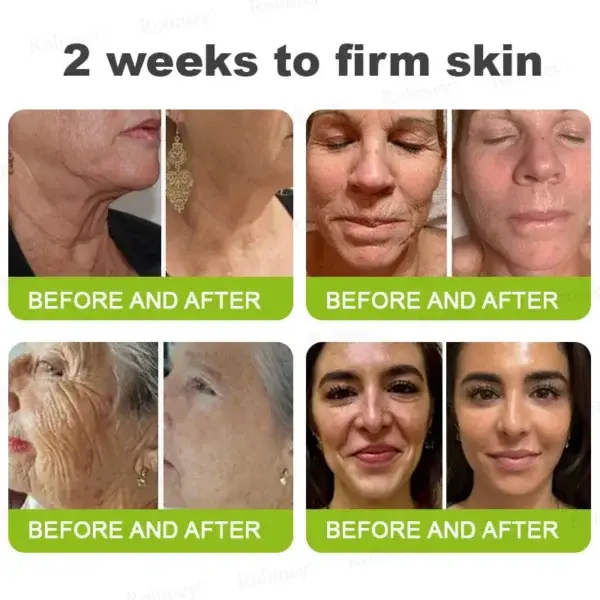 ⏰ Last Day! 70% OFF 💫 Rolimey® Botox & Vita-A Retinol Wrinkle-Lift Cream – Made & Shipped from CA 🔥