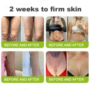 ⏰ Last Day! 70% OFF 💫 Rolimey® Botox & Vita-A Retinol Wrinkle-Lift Cream – Made & Shipped from CA 🔥