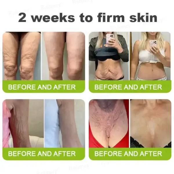 ⏰ Last Day! 70% OFF 💫 Rolimey® Botox & Vita-A Retinol Wrinkle-Lift Cream – Made & Shipped from CA 🔥